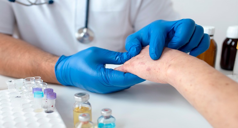 Penyakit Kusta Bisa Disembuhkan, Ini Menurut Dokter